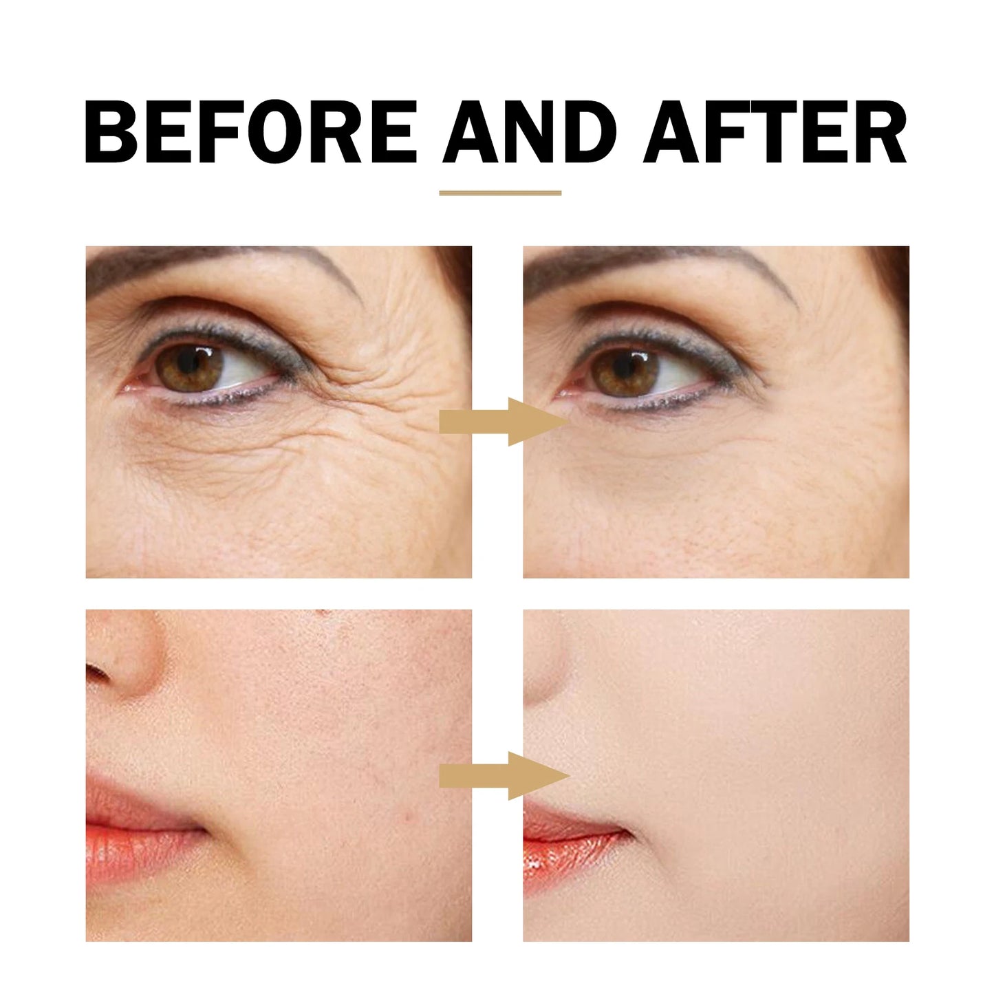 Serum facial de niacinamida con textura ligera para poros