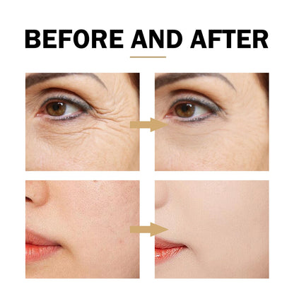 Serum facial de niacinamida con textura ligera para poros